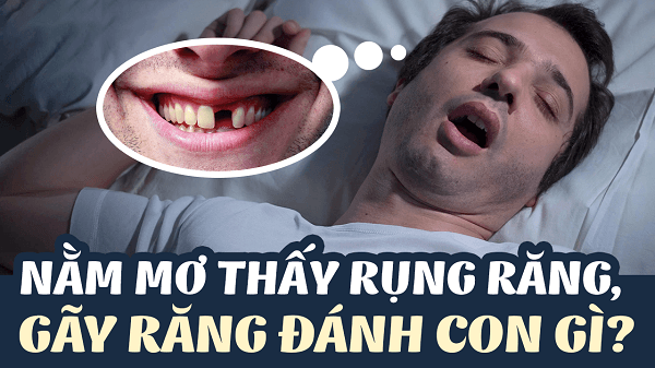 Những con số đẹp giải đáp về thông tin mơ rụng răng đánh con gì